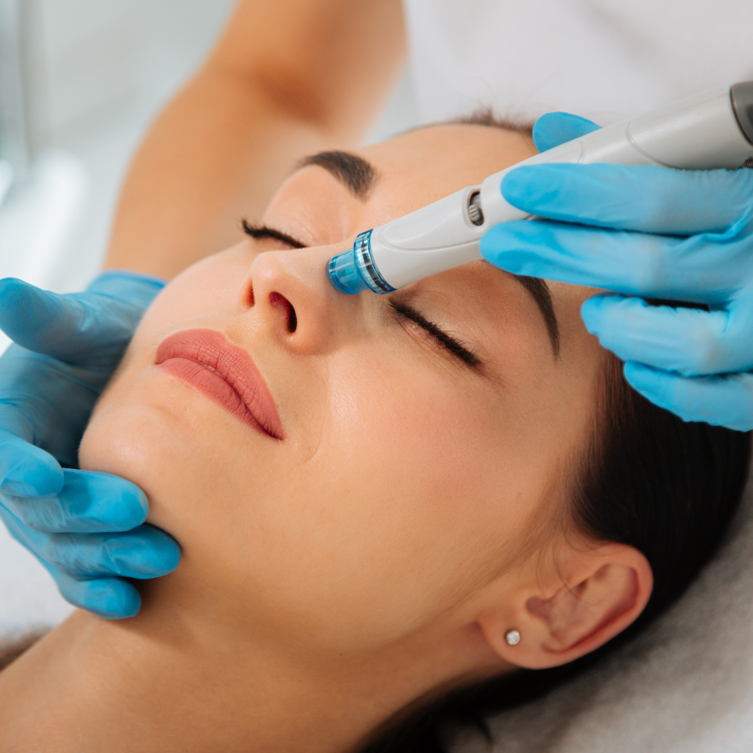 Why Choose Ultra Wellness Medical for Your Hydrafacial?